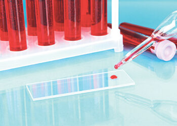 Изобретён тест для диагностики болезни Паркинсона по крови